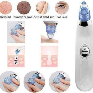 Blackhead Suction Remover & Pore Vacuum